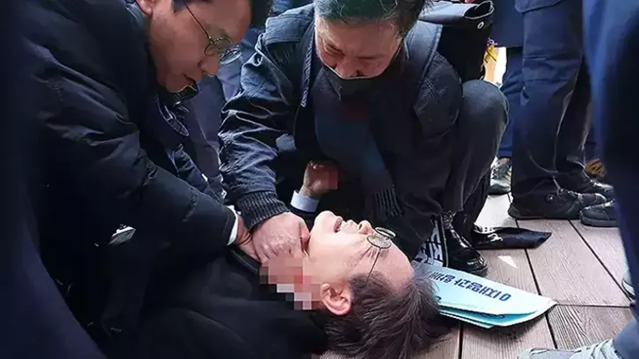 Ana muhalefet lideri boynundan bıçaklandı
